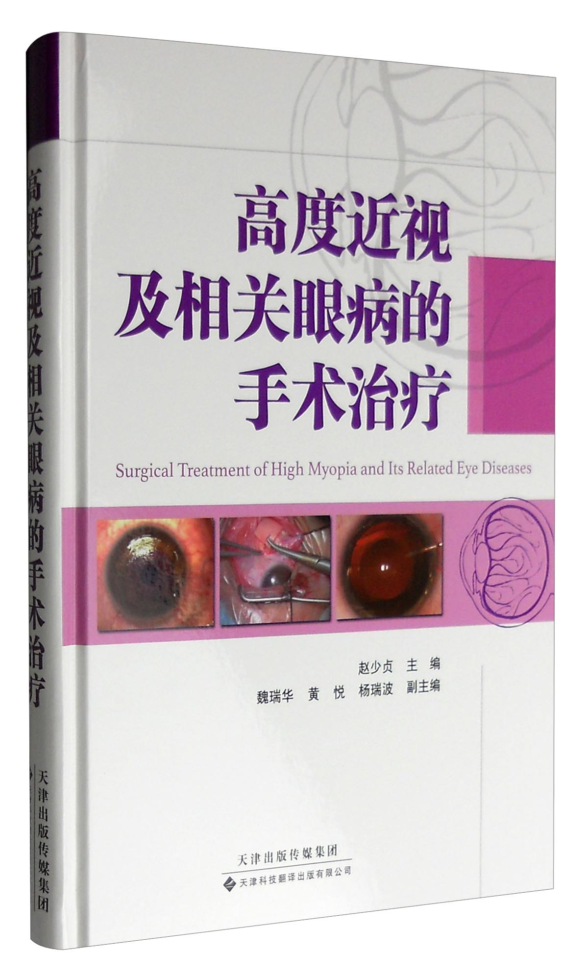 高度近视及相关眼病的手术治疗