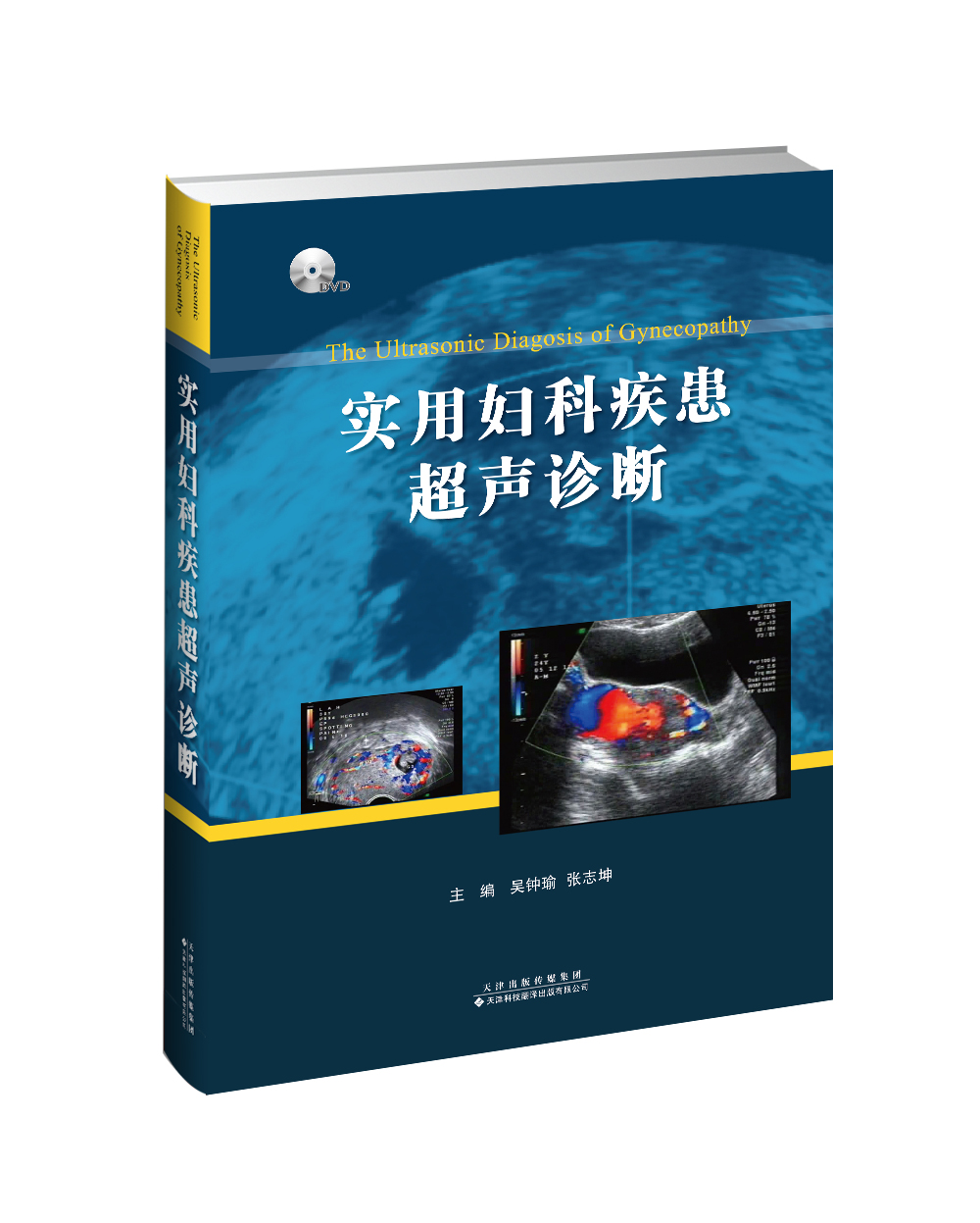 实用妇科疾患超声诊断
