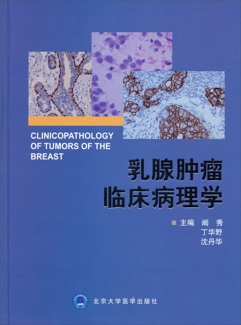乳腺肿瘤临床病理学