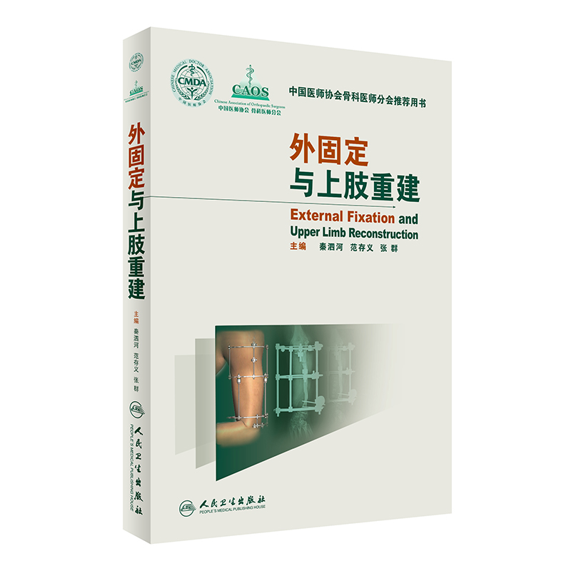 外固定与上肢重建