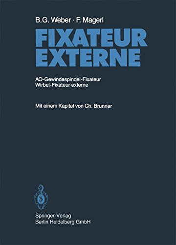 【预订】fixateur externe