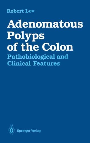 【预订】adenomatous polyps of the colon