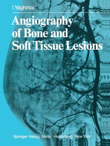【预订】angiography of bone and soft tissue
