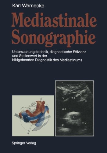 【预订】mediastinale sonographie