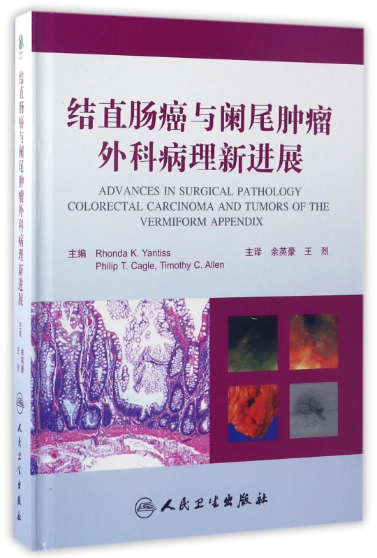 结直肠癌与阑尾肿瘤外科病理新进展(精)