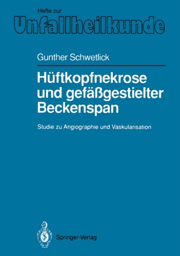【预订】huftkopfnekrose und gefassgestielter