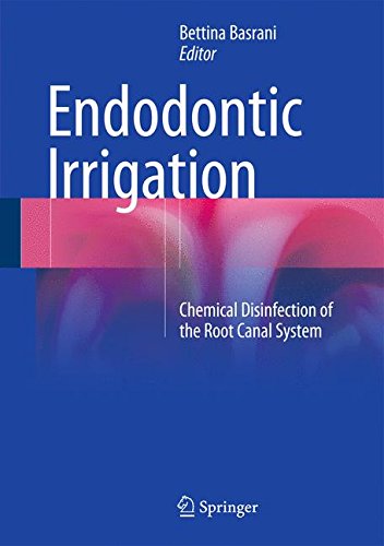 【预订】endodontic irrigation