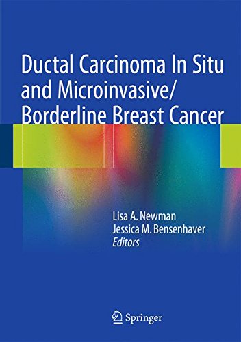 【预订】ductal carcinoma in situ and
