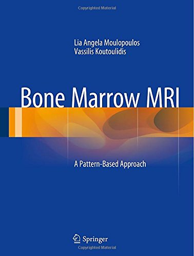 【预订】bone marrow mri