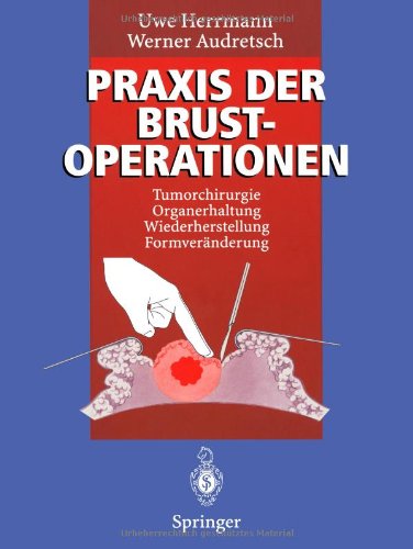 【预订】praxis der brustoperationen