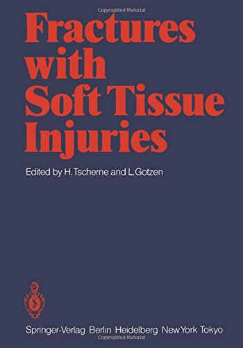 【预订】fractures with soft tissue