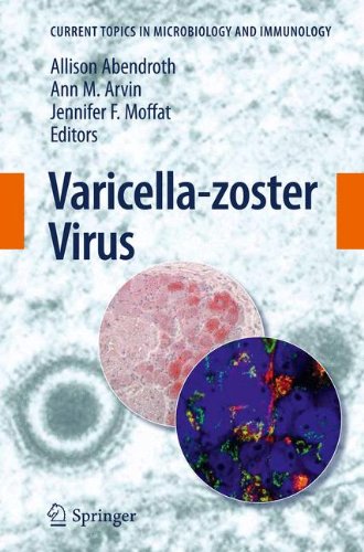 【预订】varicella-zoster virus