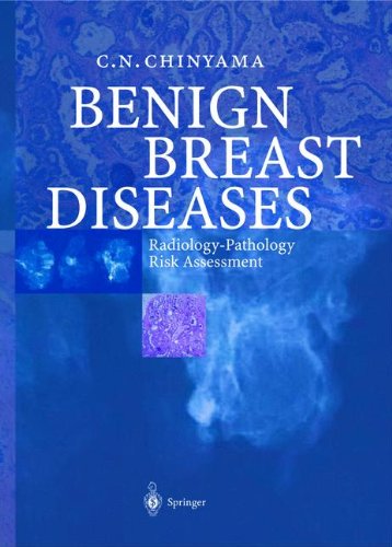 【预订】benign breast diseases: radiology
