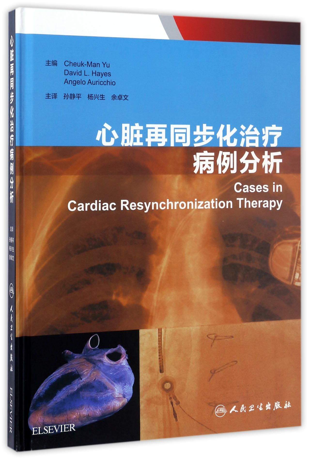 心脏再同步化治疗病例分析(翻译版)
