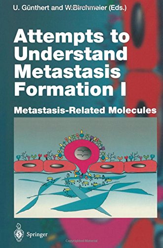 【预订】attempts to understand metastasis
