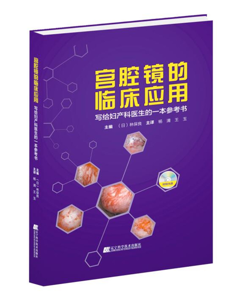 宫腔镜的临床应用 写给妇产科医生的一本参