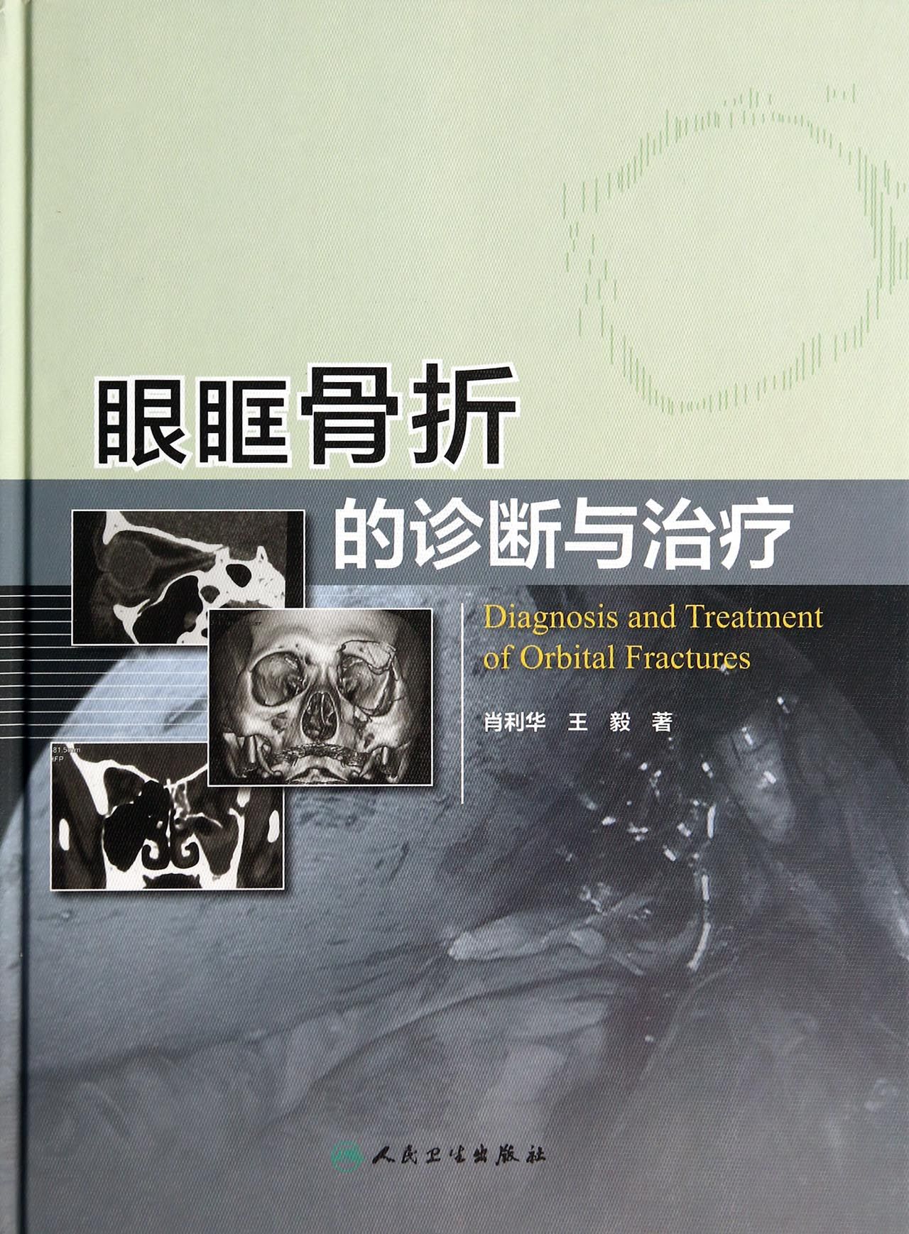 眼眶骨折的诊断与治疗(精)