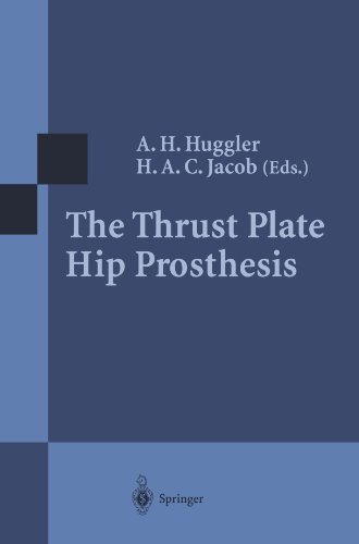 【预订】the thrust plate hip prosthesis