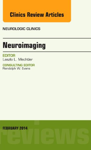 【预订】neuroimaging, an issue of neurologic
