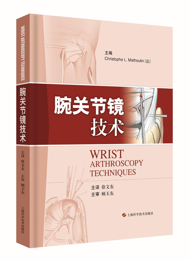 腕关节镜技术