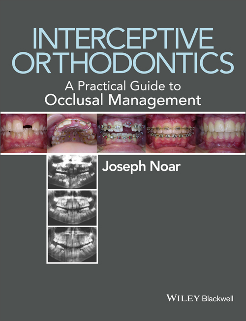 interceptive orthodontics: a practical guide to occlusal