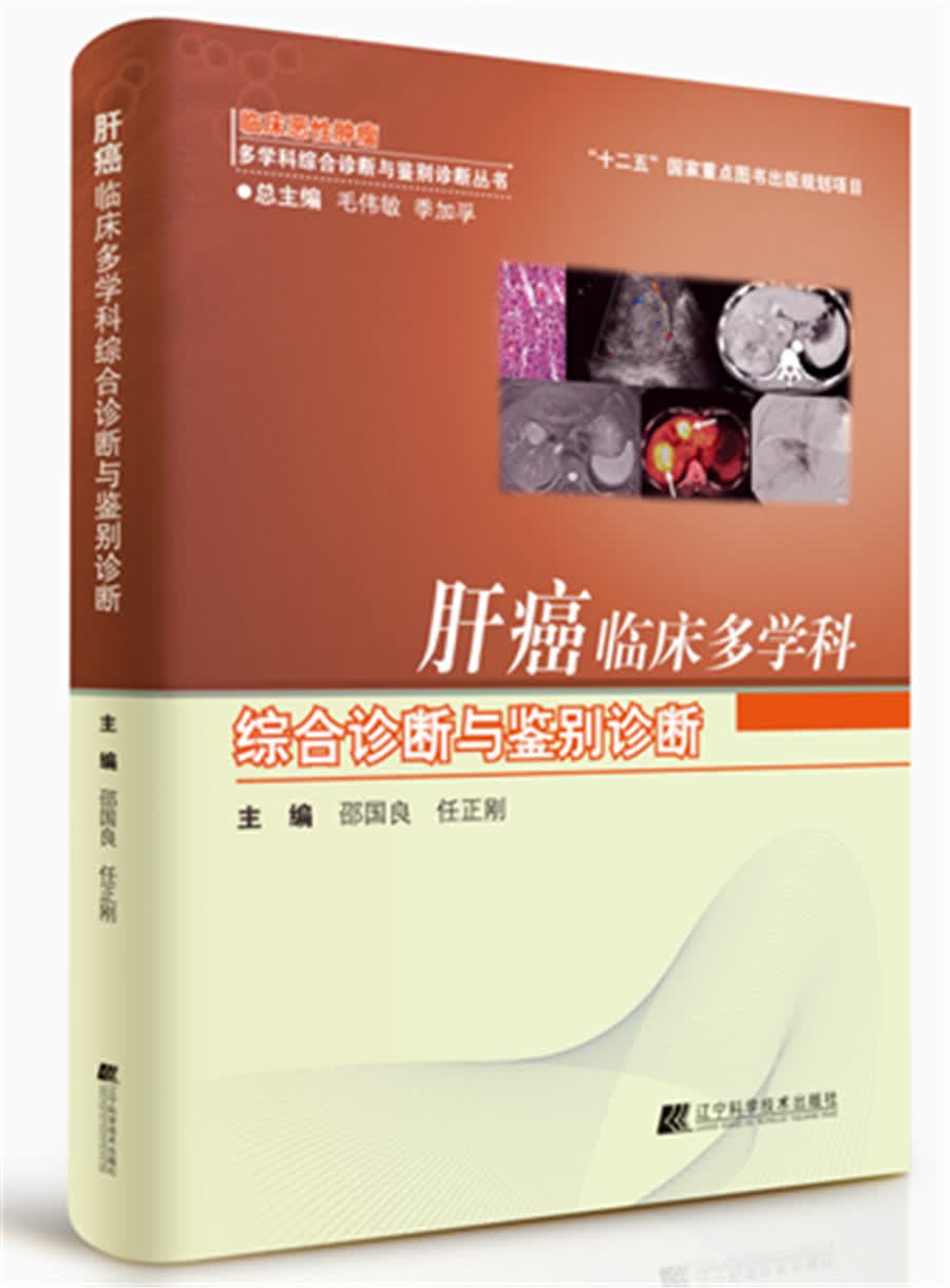 肝癌临床多学科综合诊断与鉴别诊断