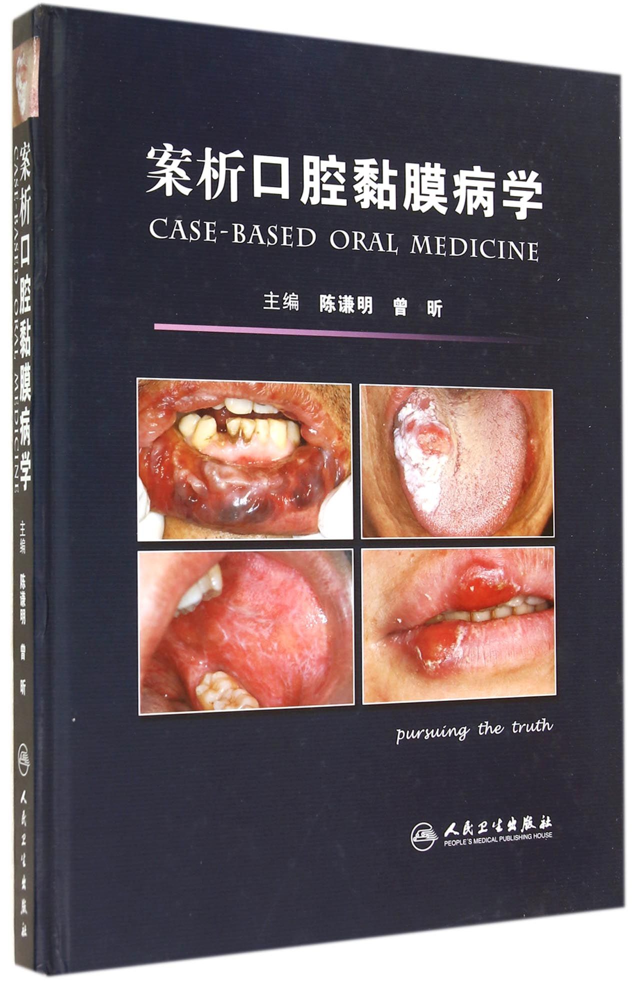 案析口腔黏膜病学