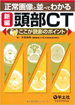 正常画像と並べてわかる新編頭部ct