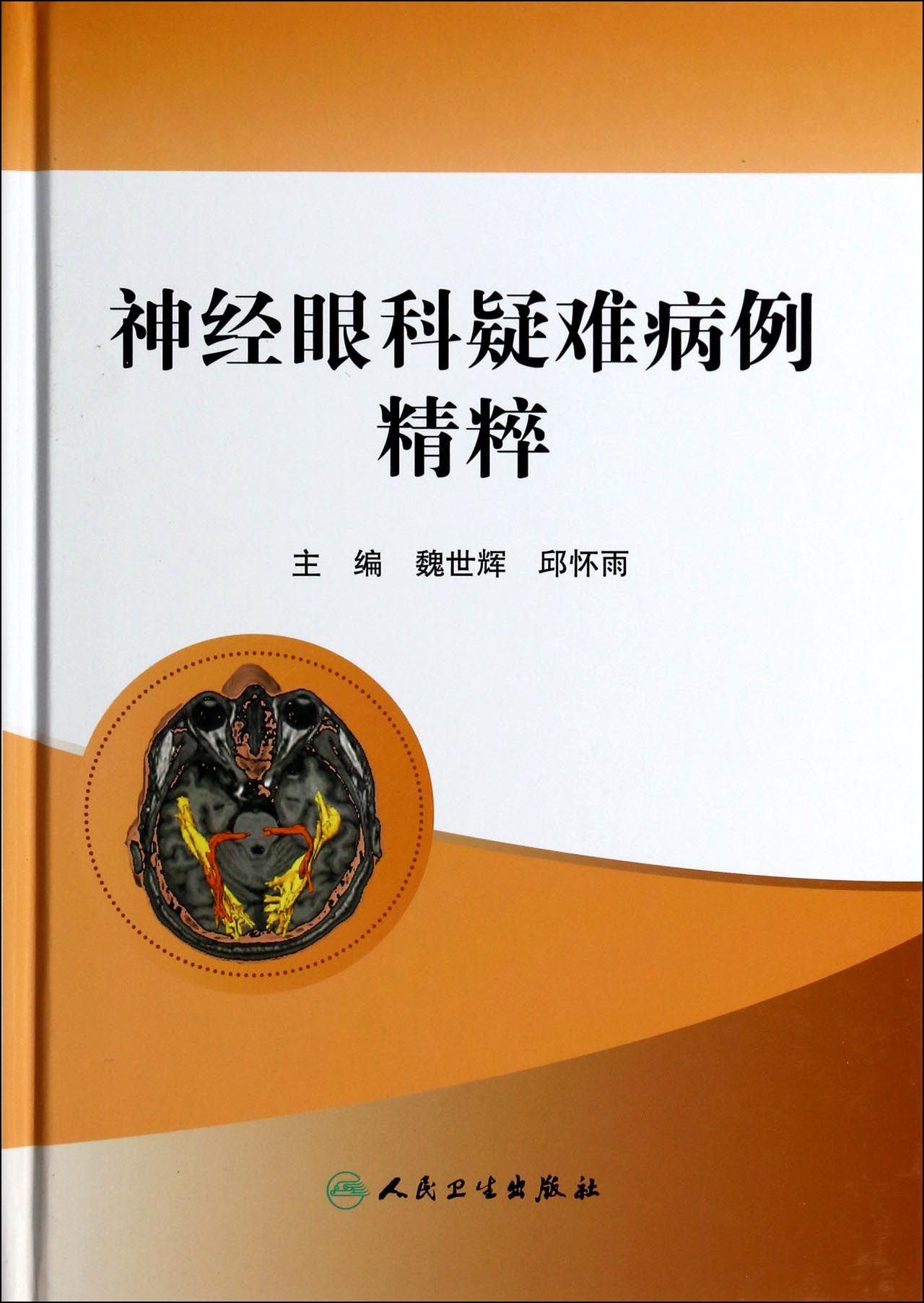 神经眼科疑难病例精粹(精)