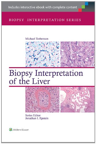 【预订】biopsy interpretation of th