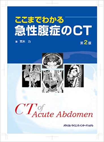 ここまでわかる急性腹症のct