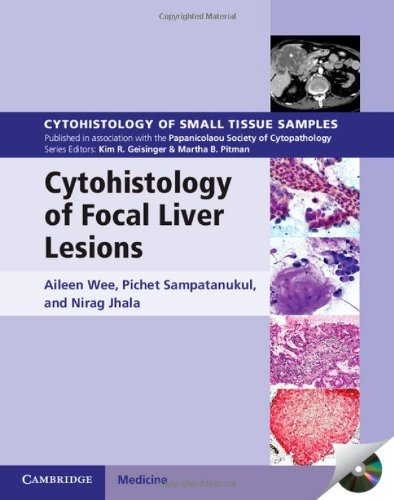 【预订】cytohistology of focal liver