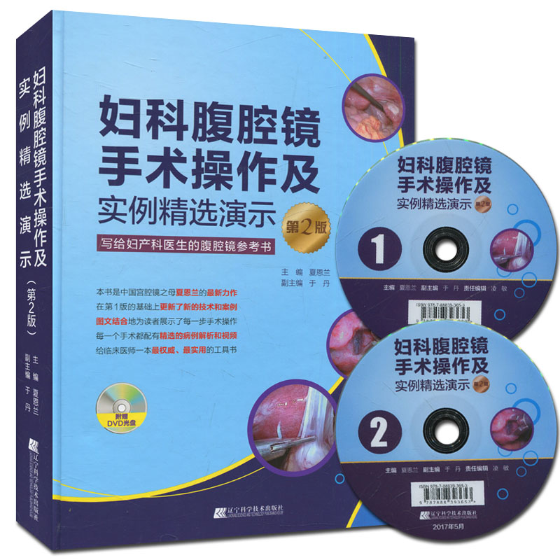 妇科腹腔镜手术操作及实例精选演示 第2版