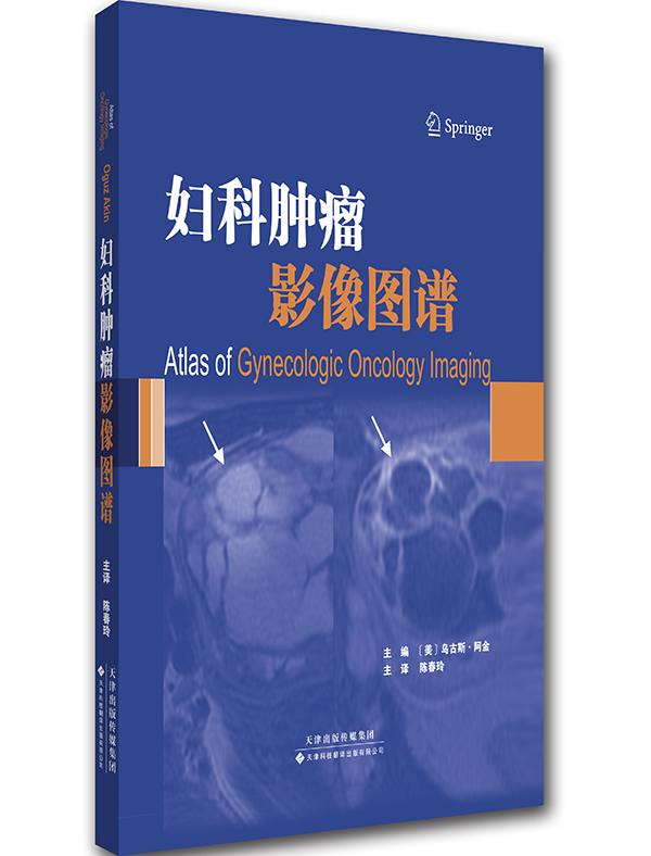 妇科肿瘤影像图谱