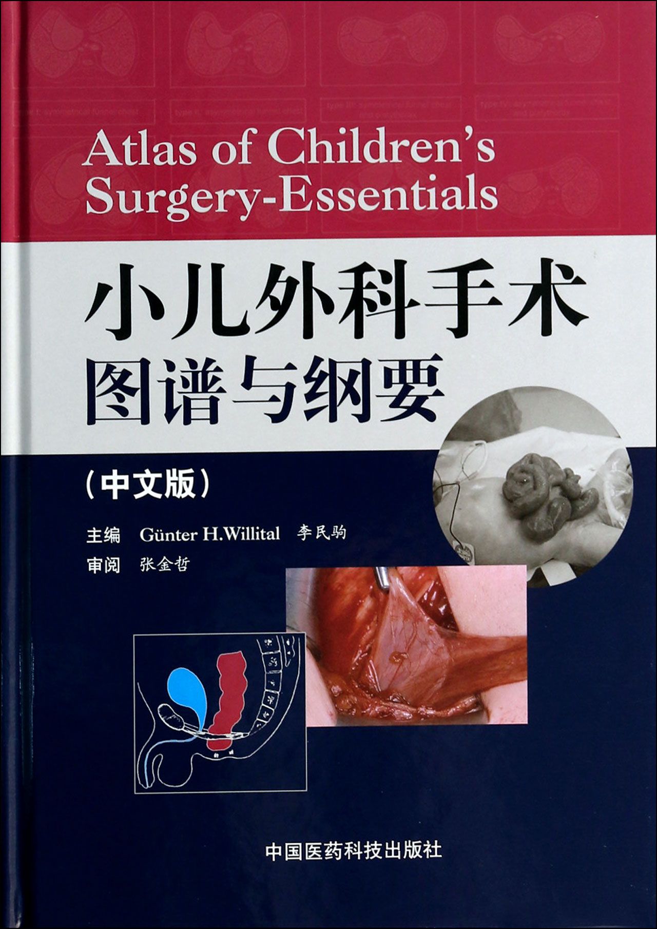 小儿外科手术图谱与纲要(中文版)(精)