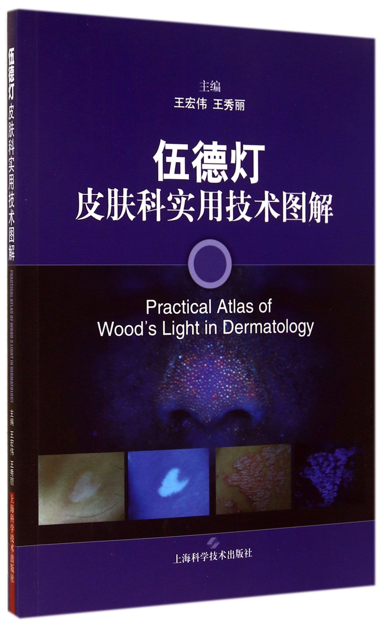 伍德灯皮肤科实用技术图解 306349~9787547824122