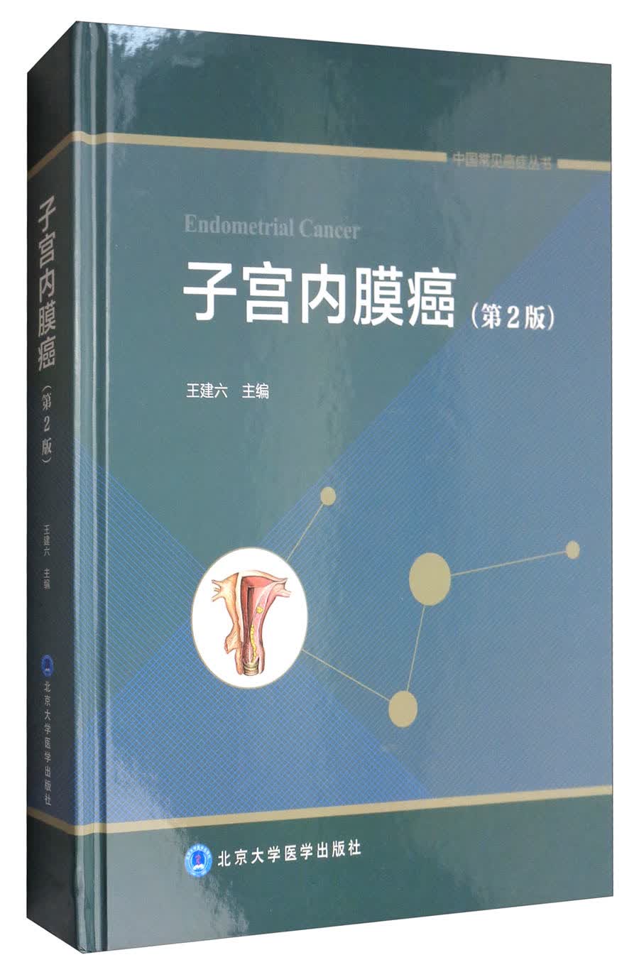 中国常见癌症丛书：子宫内膜癌（第2版）