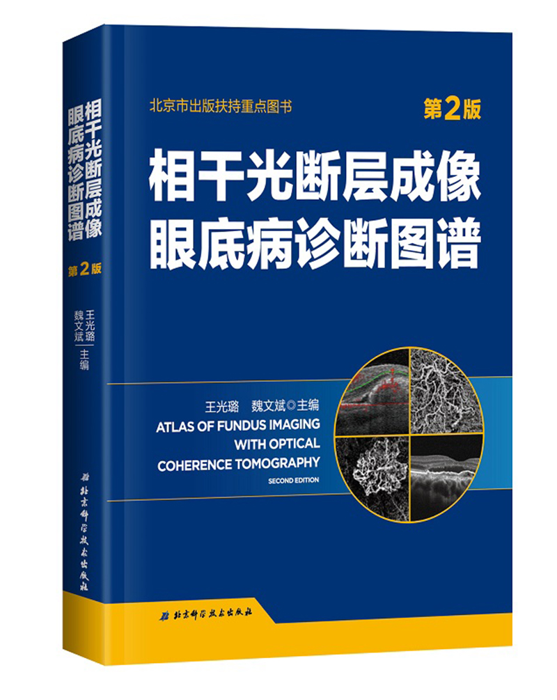 相干光断层成像眼底病诊断图谱 第2版