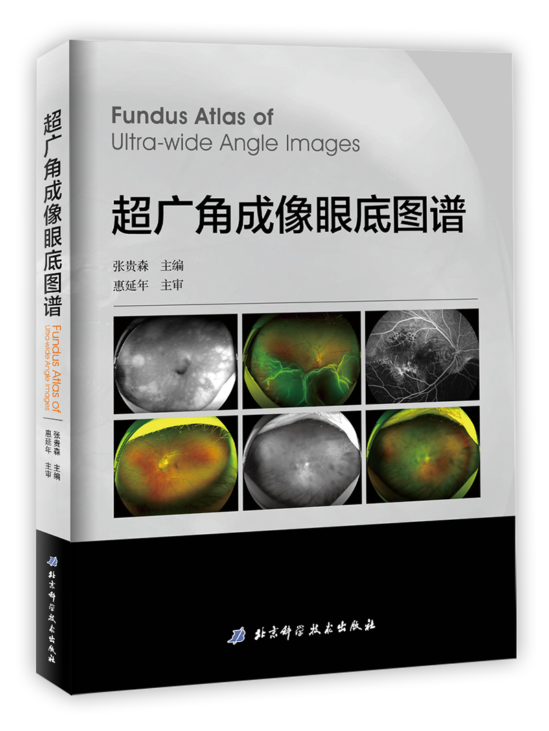 超广角成像眼底图谱