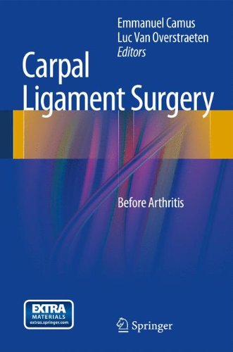 【预订】carpal ligament surgery: before