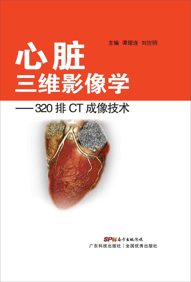 心脏三维影像学:320排CT成像技术97