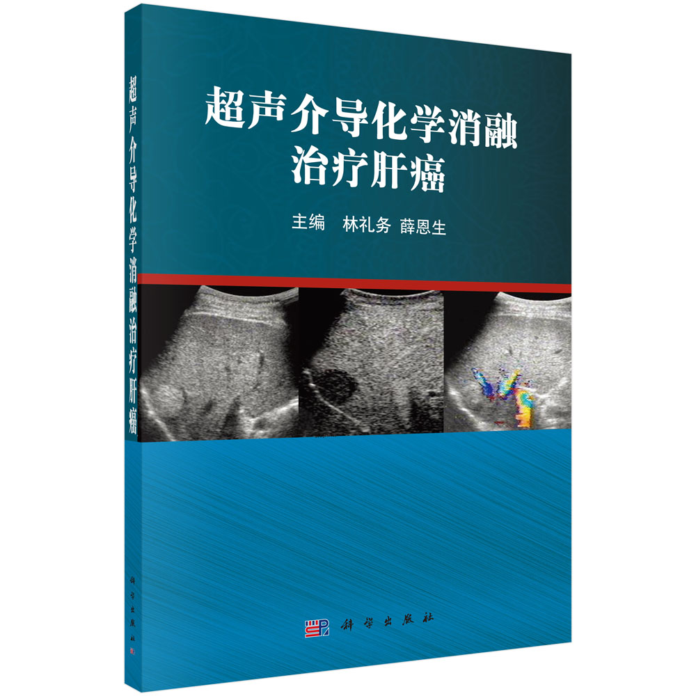 超声介导化学消融治疗肝癌97870304