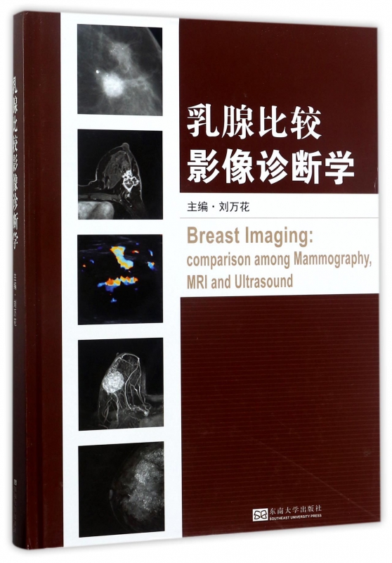 乳腺比较影像诊断学(精)