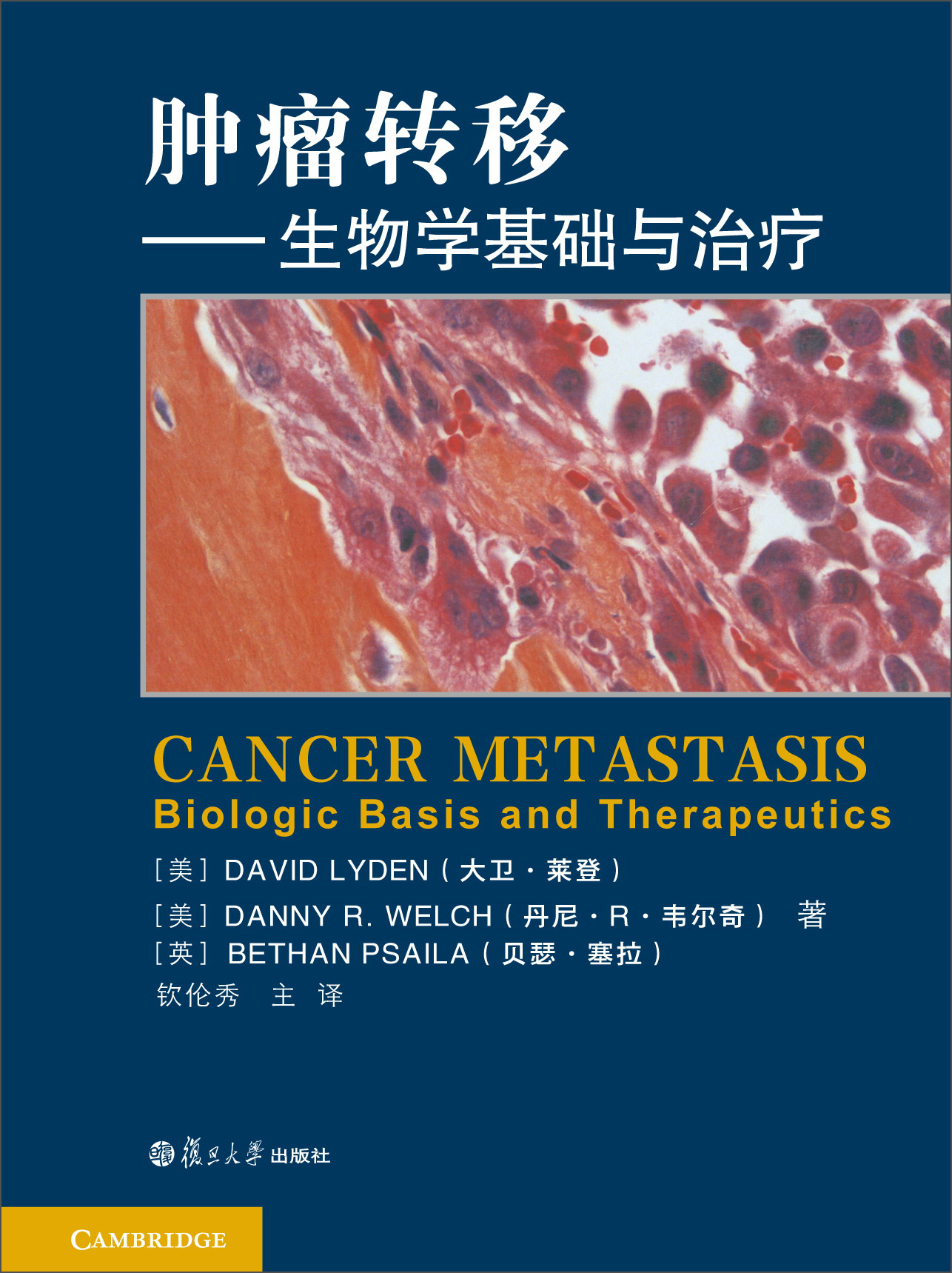 [正版图书]肿瘤转移：生物学基础及治疗
