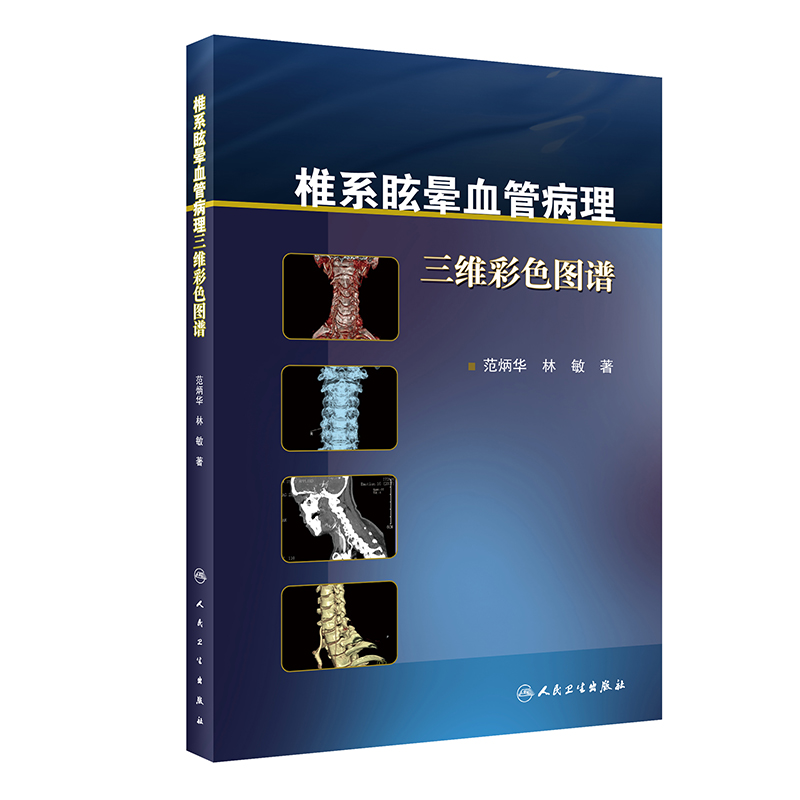 椎系眩晕血管病理三维彩色图谱