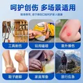 诺宁创口贴普通型强粘透气日常敷贴防磨脚贴常备小擦伤愈 【20片盒装】诺宁创口贴 图片 4