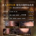 YERENTANG进口侧柏叶防脱洗发水500ml育发固发养密发控油蓬松中草药洗发液 图片 4