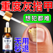 李时珍灰指甲膏第1款名特专用指甲抑菌真菌感染脱甲坏效脚指甲增厚修护 2盒装【99%患者的选择非药】