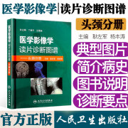 医学影像学读片诊断图谱 头颈分册 耿左军 杨本涛 人民卫生出版社