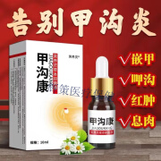 脚总管甲沟康专用消肿消毒液药甲勾炎器贴手脚趾灰指甲软甲嵌甲 1盒